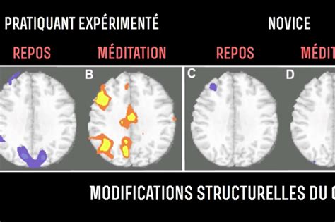 Quels sont les effets de la méditation sur le cerveau Quels sont les effets de la méditation sur le cerveau
