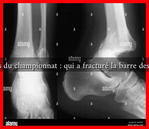 Les résultats du championnat : qui a fracturé la barre des 30 points ? Les résultats du championnat : qui a fracturé la barre des 30 points ?