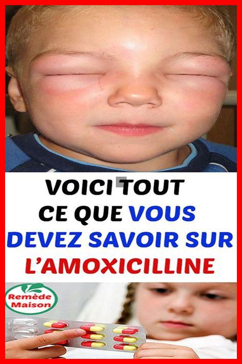 Comment prendre l’Amoxicilline correctement Comment prendre l'Amoxicilline correctement