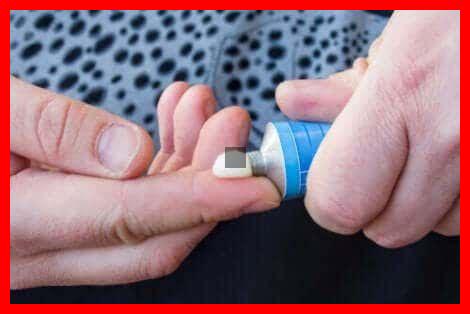 L’hydrocortisone est-elle efficace contre les allergies L'hydrocortisone est-elle efficace contre les allergies