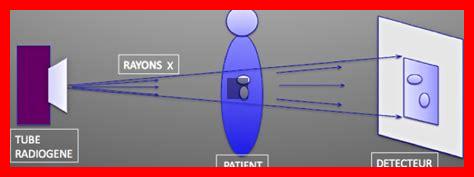Quelles sont les différences entre les rayons X et les ultrasons Quelles sont les différences entre les rayons X et les ultrasons